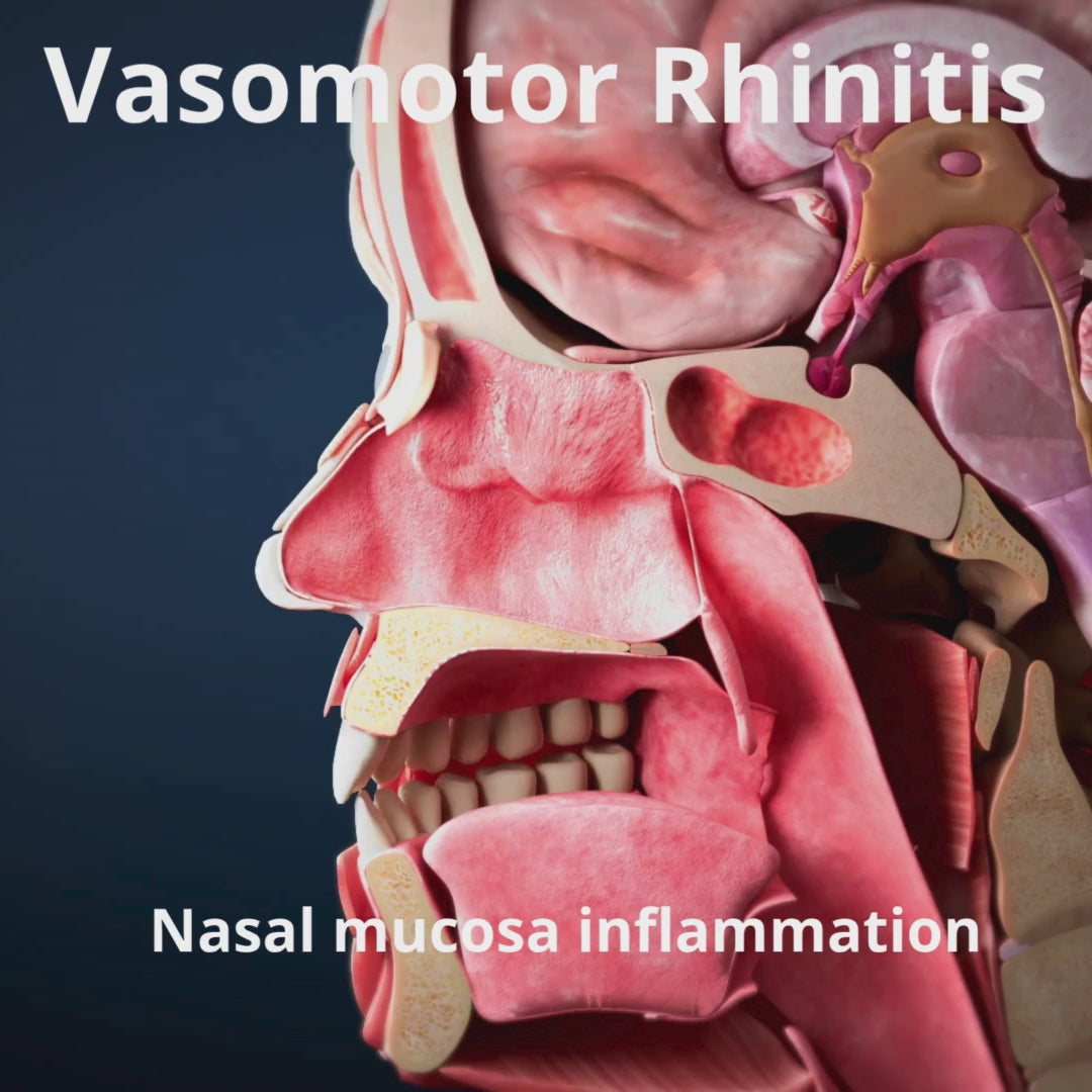 Video laden: Celmast Nasenspray - Erwachsene