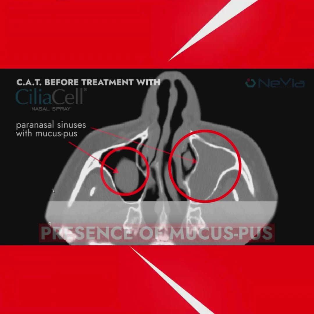 Cargar vídeo: CiliaCell Spray Nasal - Adultos